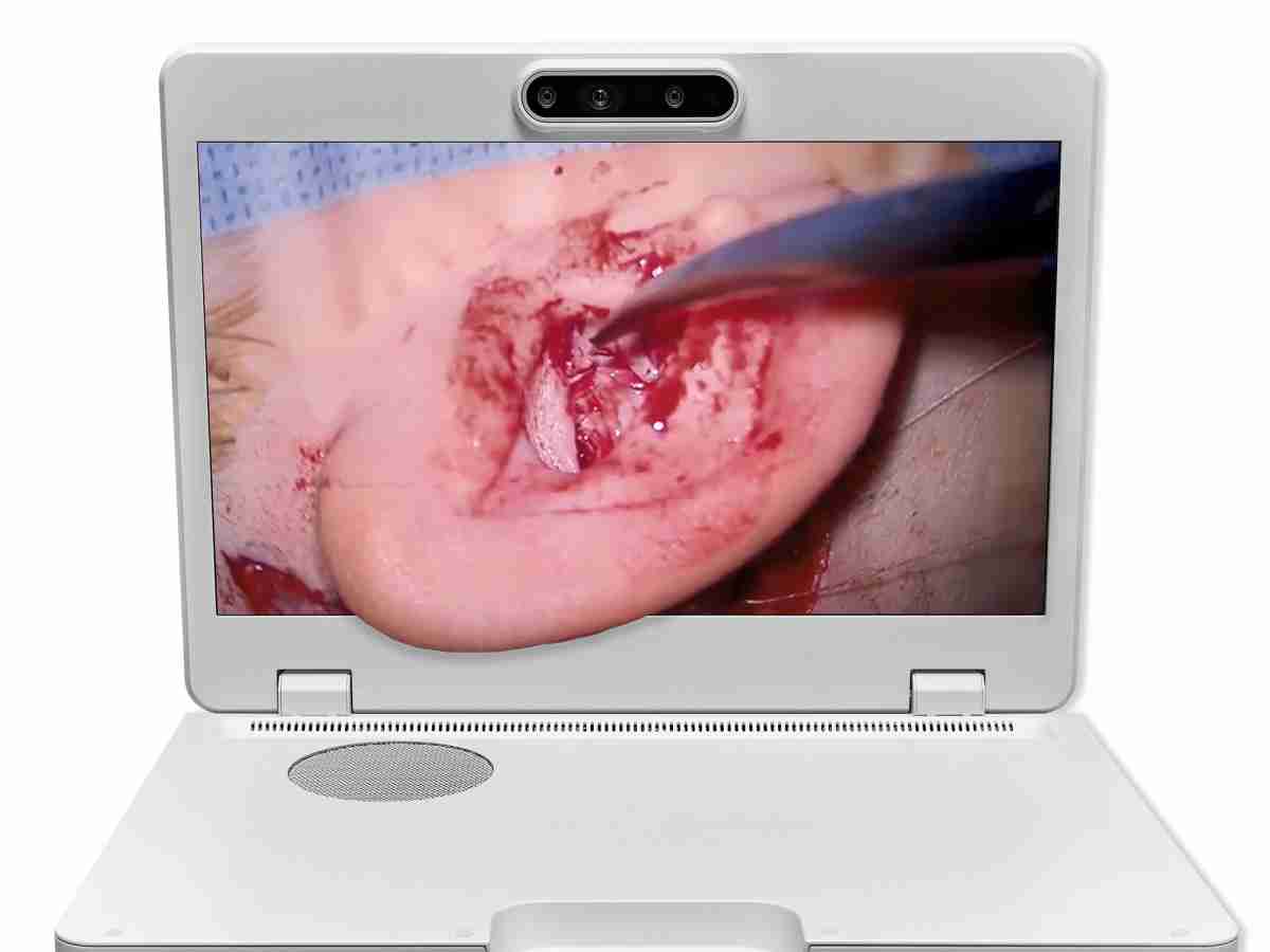 达擎之＂Heads-up 3D显微手术显示系统＂，，，，整合4K裸眼3D显示及眼球追踪系统，，，，具备快速追踪人眼移动位置功能，，，，减轻医师长时间维持固定姿势的负担，，，，让医师能有更宽广清晰的3D立体视野及更舒适的姿势来执行手术。。。。